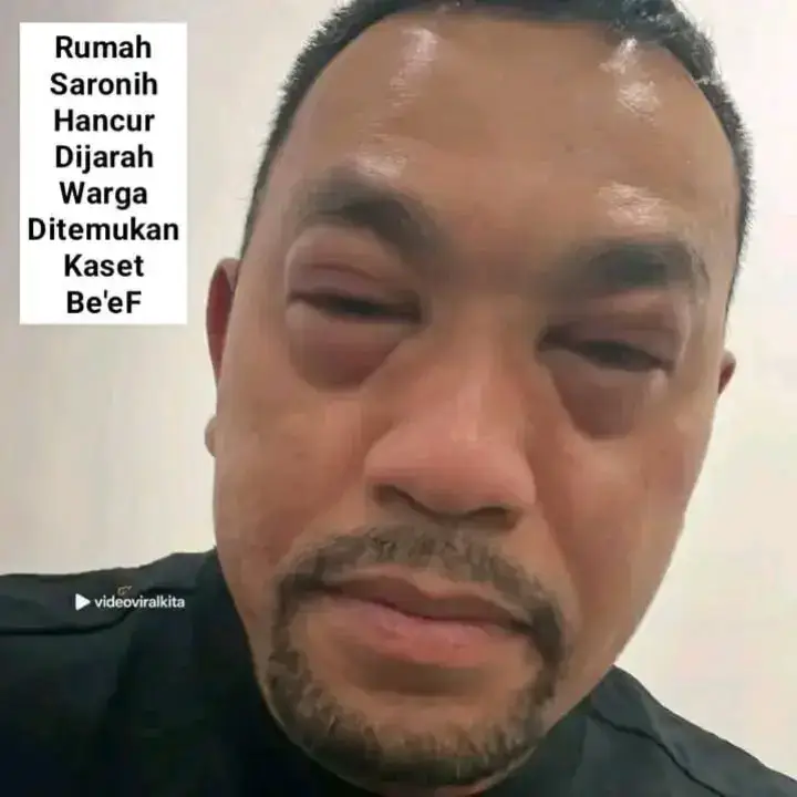wkwkwk 😂 #ahmadsahroni #core #viral #demodpr #fyp