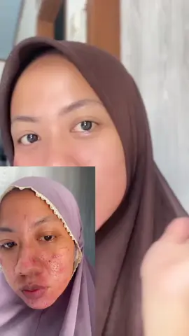 yang mauuu kinclong harus punyaaaaaaa #SkincareKorea #SpringOrigin 