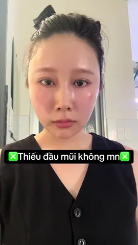 Sửa mũi 1 tháng 2 tuần kết quả thiếu đầu mũi không mấy bà??#xuhuong #pttm #mũi #môi #mắt 