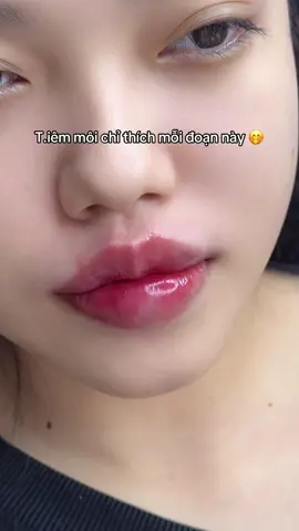 Môi babie hot “trend” bestseller nhà tui 💗 #ynbeauty #xuhuong #tiemmoi #fyp #moibaby #lamdep 