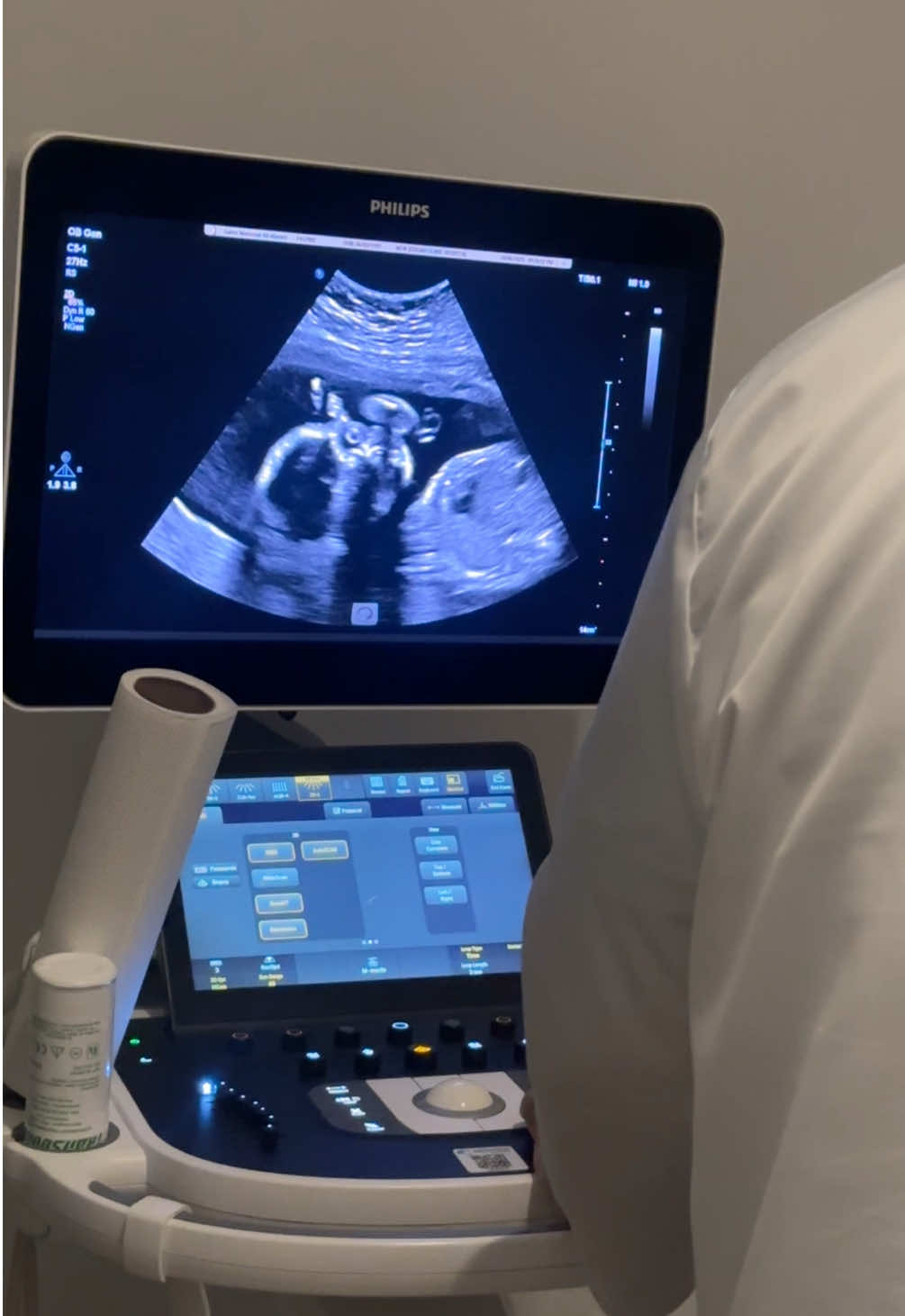 وسط روحي روح بأصابع صغيرة 🥺🤏🏻🤍 #33weekspregant #explore #newmom #pregnant #trending 