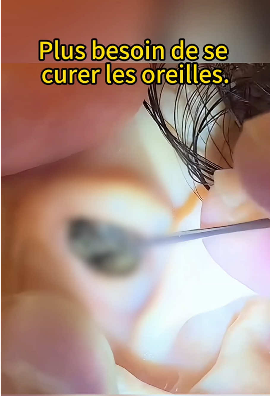 Continue à faire ça si tu veux des ruches de miel à la place des oreilles 🐝 #hygiene #oreille #pourtoi #sante #propre?