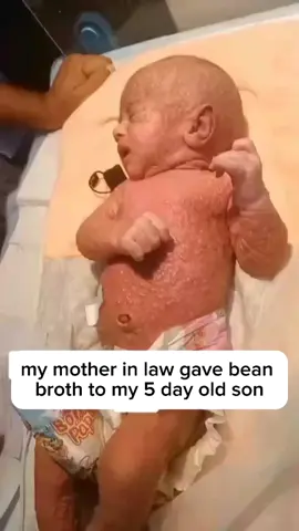 My mother-in-law gave food to my 5-day-old son and he ended up in the ICU #icu #motherinlaw #premature #hospital 
