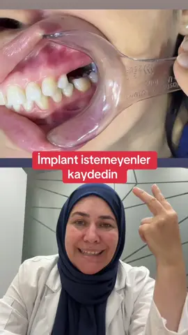İki dil eksikse #implant #veneer #tiktok #fyp #fpy 