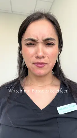 2 full weeks and I’m smooth 😎 #balancedbybrianna #atxinjector #atxbotox #atxmedspa @WELLNEST 