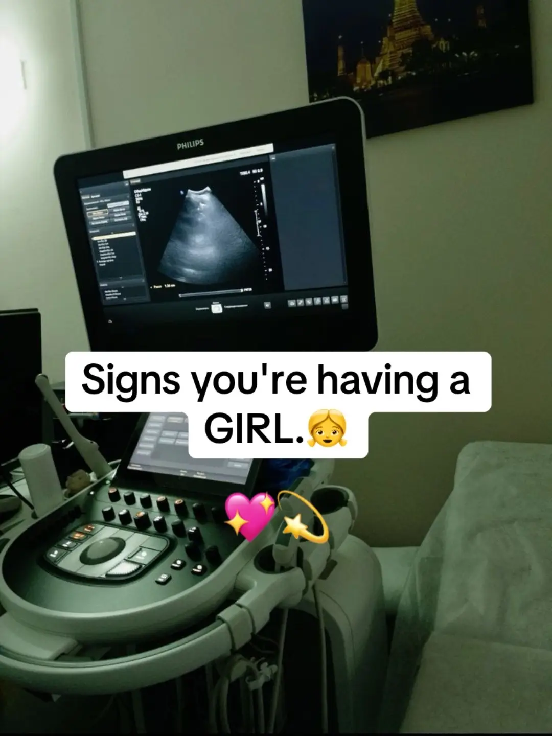 #pregnancytips #momlife #pregnancysymptoms #firsttrimester #MomsofTikTok