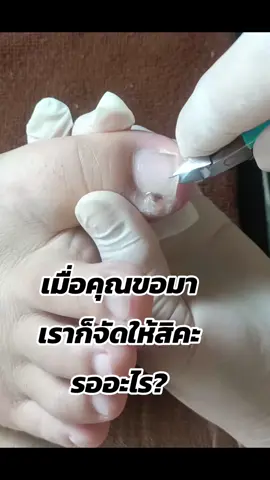 #tiktoklive #livehighlights @@รุ่งตัดเล็บขบบ้านดู่เชียงราย @@รุ่งตัดเล็บขบบ้านดู่เชียงราย @@รุ่งตัดเล็บขบบ้านดู่เชียงราย #ตัดเล็บขบมียาชาเชียงราย #รุ่งตัดเล็บขบมียาชาบ้านดู่เชียงราย #ตัดเล็บขบเชียงราย 