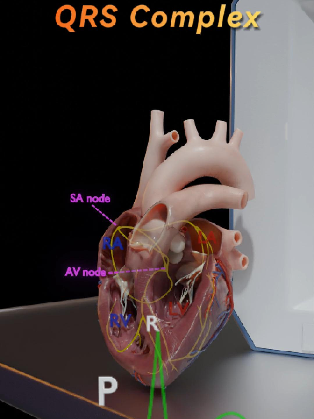 What happens between your atria and ventricles? That’s the PR interval—a tiny AV node pause that keeps your heart in rhythm. Then comes the QRS complex—your ventricles firing with a Quick Rapid Squeeze 💥 Quick EKG tips: ⚡ PR too long? Think heart block ⚡ QRS wide? Conduction is slowed ⚡ Normal QRS = strong, efficient squeeze 📚 Perfect for nursing students + med pros 🎥 Follow @NursesCompass for more fast, animated EKG tips! #EKGtips #NursingSchool #AVNode #QRS #HeartBlock #MedTok #NursesOfTikTok