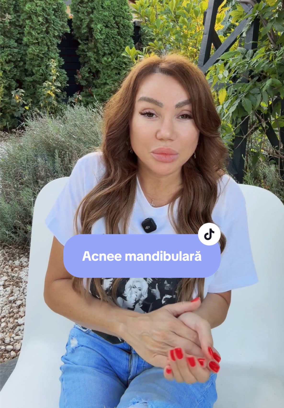 Între Before și After este vorba despre puterea disciplinei, iar abordarea corectă este o formulă simplă, dar constantă, de curățare și refacere a integrității pielii și a încrederii în sine! #beforeafter #acnefighter #skinproblems #acnee #acneskincare 