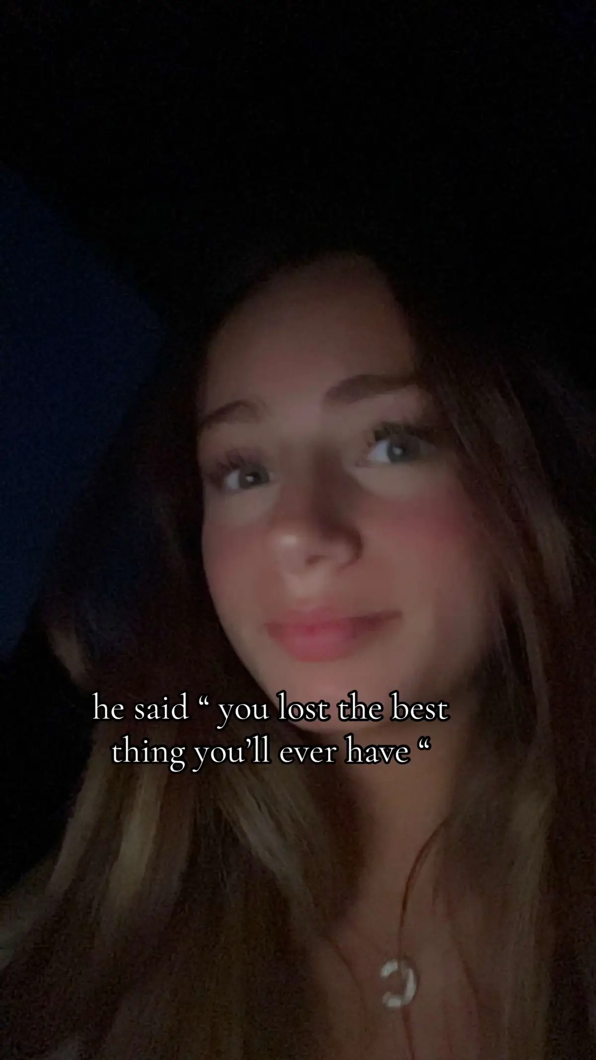 @mvp 