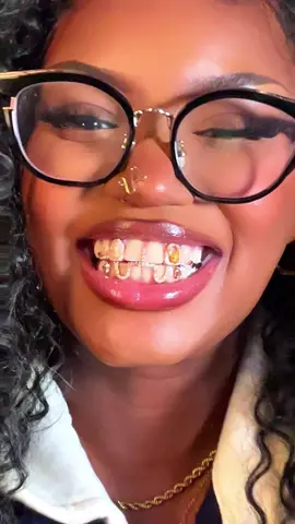 Thank you @theigtgrillz for my custom Eevee grillz. Use code “Evensya” for 20% off ✨😮‍💨  #grillz #pokemon #animegrillz 