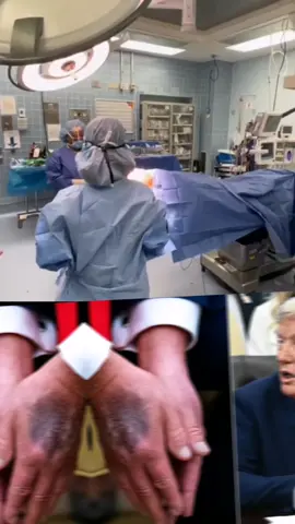 et enfin on vient de découvrir la vraie réalité cachée derrière la maladie de Donald Trump. #donaldtrump #maladie #autopsie #france #etatsunis 