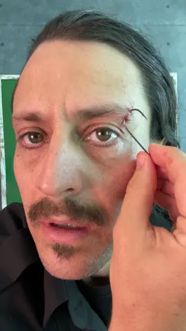 Fishhook stuck in your eye? Don’t try this… 