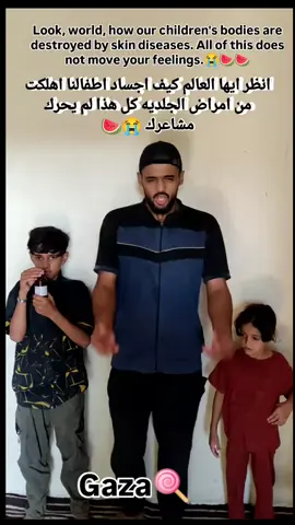 We are a deaf family in Gaza, forgotten and starving. We can’t hear the bombs, but we feel the hunger, the pain, the silence of a world that won’t help.