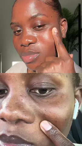 Name a better feeling than this  #SkinCare101 #skincaretips #skintok #skincare #skin 