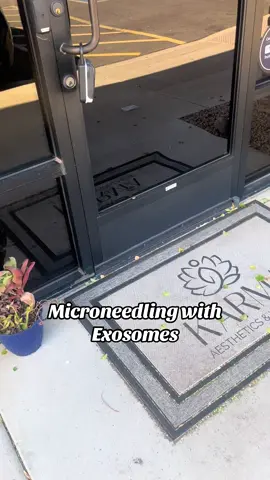 Microneedling with exosomes 😍 I can’t say enough about how good this treatment is for your skin. I’m one week out and have noticed my skin texture has improved so much, pores are smaller, skin is brighter and more hydrated. Dm me if interested we are currently running specials on microneedling this month! #azmedia #azinjector #azskincare #exosomes #microneedling 