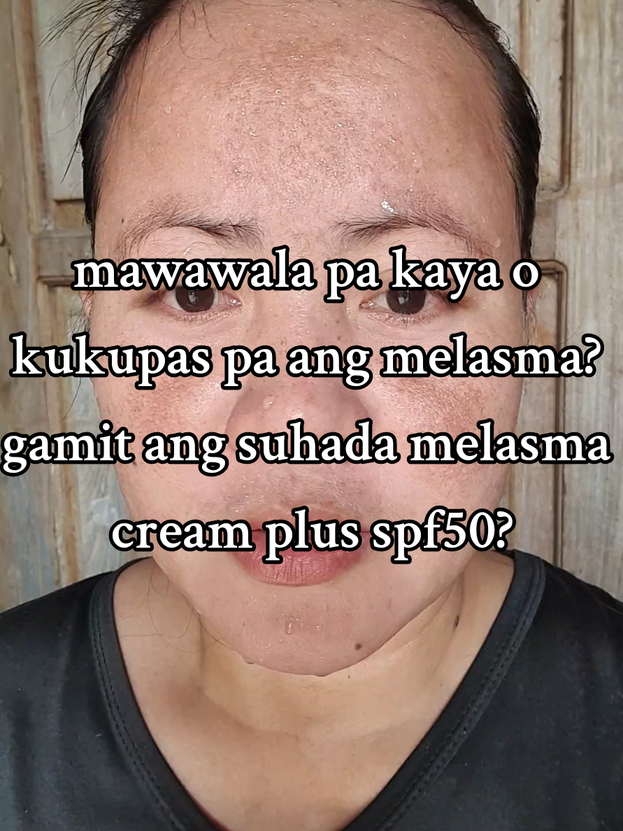 1month body and face pospartum  melasma and dark pigmentation all over my face #melasmaproblem #suhadaphilippines #melasmacreamplusspf50 #antiagingcream #whitheningcream 