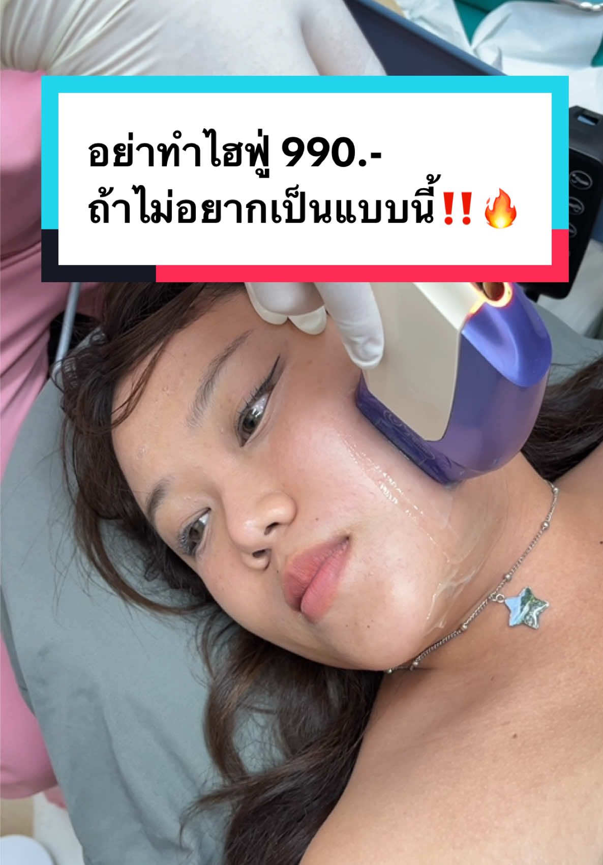 อย่าทำไฮฟู่ 990.- ถ้าไม่อยากเป็นแบบนี้‼️🔥 #AuraXpress #hifu #ไฮฟู่ #ไฮฟู่ยกกระชับ #ยกกระชับหน้า  