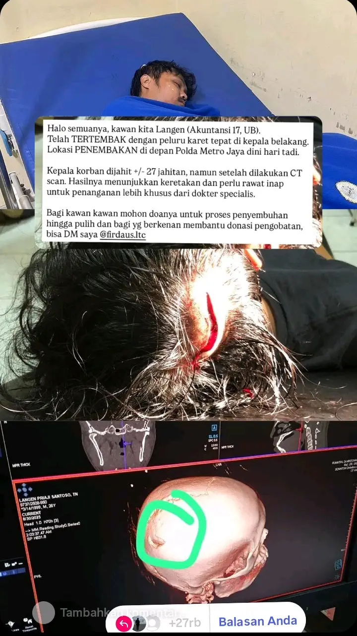 seorang mahasiswa di, tembak dengan peluru karet😭😌 #mahasiswa #demo_dpr #foryoupage #masukberandafyp #acehviral_jakartaviral2025