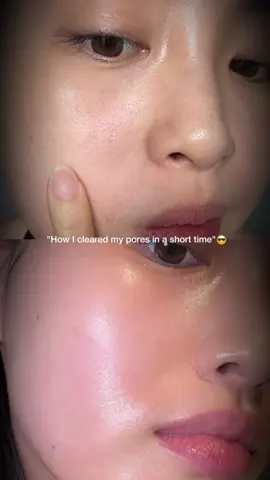 All it took was one switch — and hello, poreless glass skin. ✨ #franklyskincare #koreanskincare #poreless #franklycloserserum #skintok 