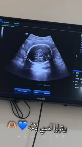 #CapCut #حوامل_شهر_سادس #حوامل_اي_شهر_صرتو_🤰🤰😍🦋 #صلو_على_النبي_صلى_الله_عليه_وسلم #الله_يطعم_الجميع_الذرية_الصالحة_🥰 