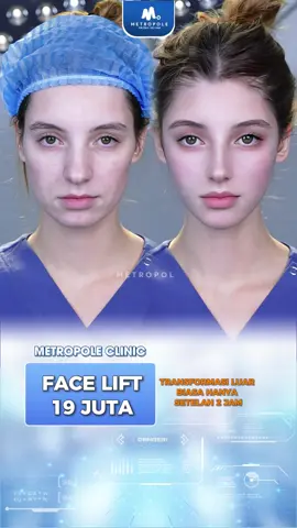 Wajah anda ingin kembali kencang dan muda? Konsul terlebih dahulu dengan dokter langsung Chat WA kami 😍🔥 #operasivietnam #awetmuda #rhinoplastyjakarta #operasi #facelift              
