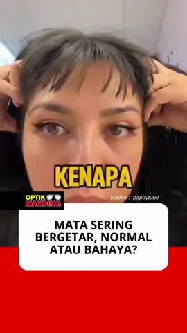Nistagmus adalah kondisi ketika bola mata bergetar atau bergerak cepat secara berulang (horizontal, vertikal, atau berputar).  Biasanya terjadi karena: •	Gangguan pada saraf pengatur pergerakan mata •	Masalah pada telinga bagian dalam (vestibular) •	Efek obat tertentu •	Atau kondisi medis lain 📌 Berbeda dengan “mata kedutan” (nervous eye tremor) yang terjadi pada kelopak mata, kalau nistagmus terjadi langsung pada bola mata. 👉 Apakah berbahaya? Nistagmus sendiri bukan penyakit, melainkan gejala dari kondisi lain. Namun, kalau sering terjadi, bisa memengaruhi penglihatan dan keseimbangan. Karena itu, penting untuk diperiksa ke dokter mata agar tahu penyebab pastinya.
