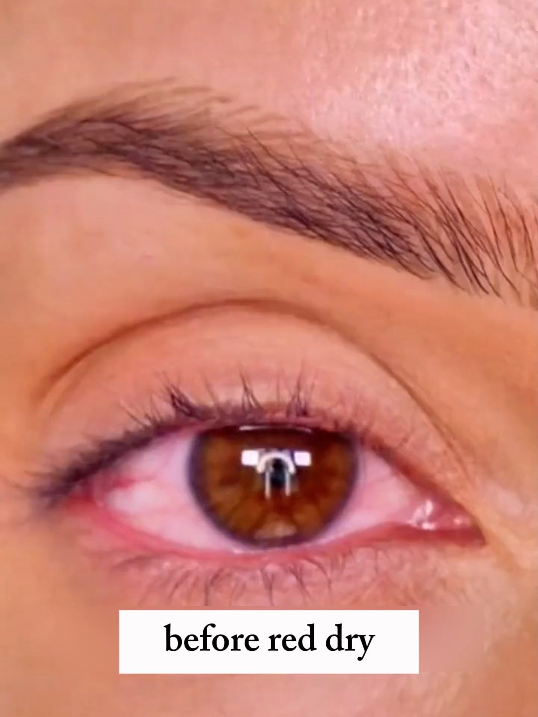 #lutein #zeaxanthin #eyehealth #luteinzeaxanthingummies #fybシ #health #body #careleaf #yourtimeisnow
