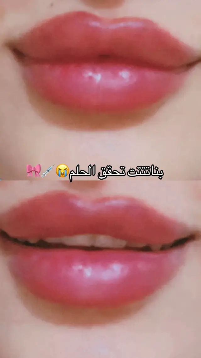 #مالي_خلق_احط_هاشتاقات🦦 #فلر_شفاه 
