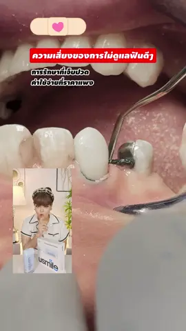 #ไหมขัดฟันพลังน้ํา #dentist #usmile #ทันตกรรม 