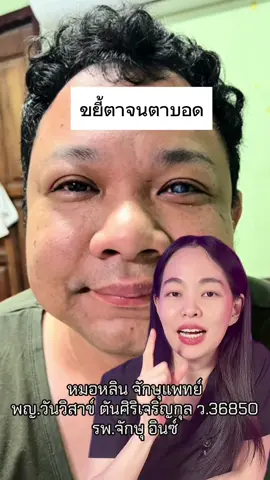 #หมอหลิน #โรงพยาบาลอินซ์ #โรคตา #จักษุแพทย์ #ตาบอด 