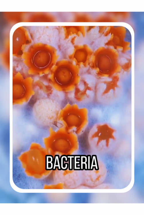 What the fucking kind of bacteria is this? #usa #usa_tiktok #america #popular #fyp #fypシ #bacteria 