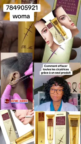#venteenligne #videoviral #venteenligne #videoviral 