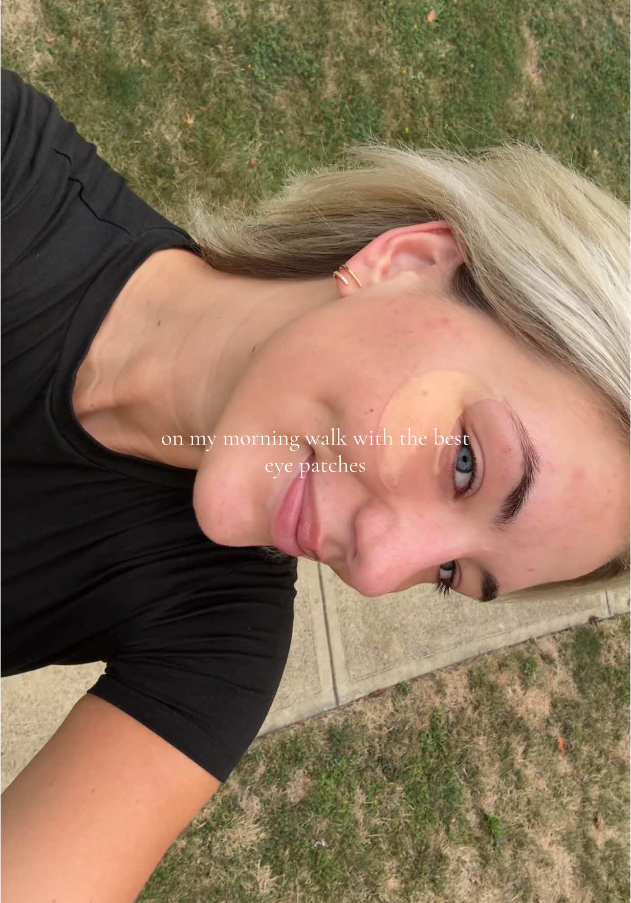 acne breakout #hydrating #eye #viral 
