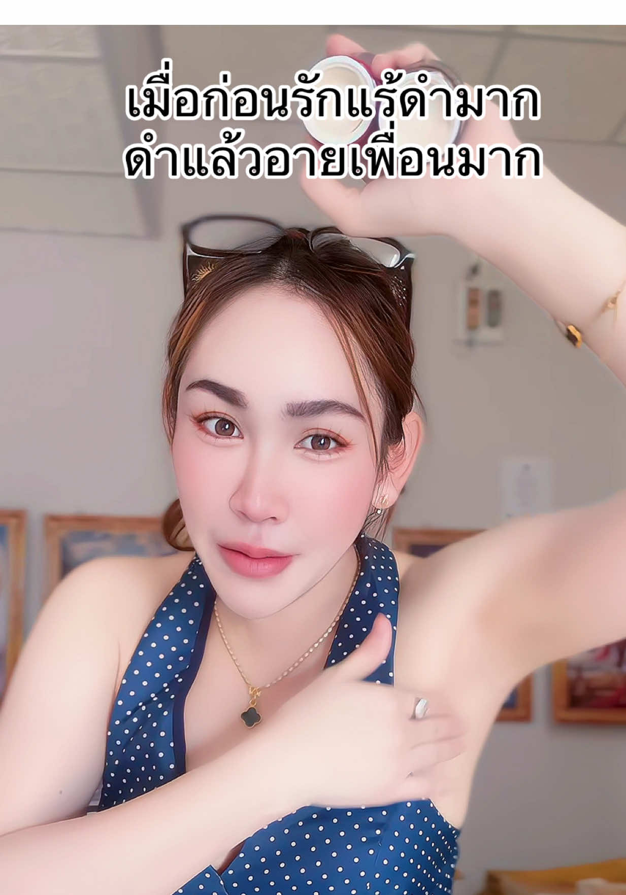 เมื่อก่อนรักแร้ดำมาก #รีวิวบิวตี้ #รักแร้ #รักแร้ขาว #คอนเกรทครีมทารักแร้ขาว #คอนเกรทครีมทารักแร้ขาว 