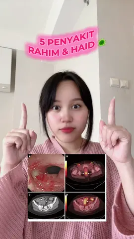 Kalo kamu merasa ada yang salah dengan rahim atau siklus haidmu, lebih baik check ke dokter yaa 🫰🏻 #menstrucare #period #haid #menstruasi #fyp 
