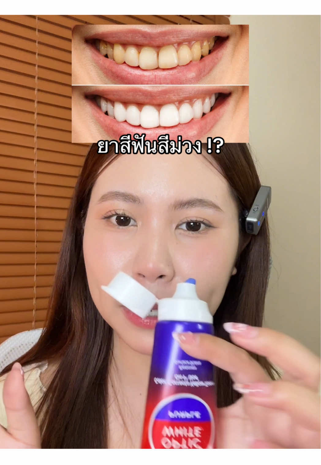 แบรนด์ในตำนาน #tiktokbeautyfestth #คอลเกต #ฟันขาว 