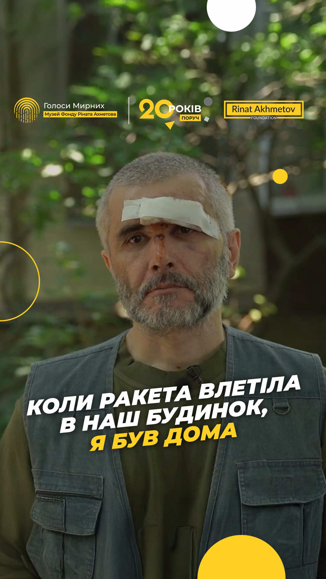 «Квартира вщент розбита. Де жити буду, не знаю», — з розпачем каже Денис. Чоловік один із тих, хто постраждав під час масованого обстрілу Києва в ніч на 17 червня 2025 року. Тоді столиця зазнала комбінованої атаки: спочатку російські шахеди, потім - ракети. Денис залишався вдома й зізнається - шкодує, що не пішов в укриття. Близько четвертої ранку ракета влучила прямо в його будинок - сьомий під’їзд зруйнувало до фундаменту!  Він жив поруч - у шостому. Від вибуху в квартиру влетіла віконна рама, уламками посікло обличчя, поряд була його літня мама - вона теж поранена. Разом, підтримуючи одне одного, вони вибралися з будівлі. На вулиці горіли машини, а навколо були уламки й дим. Їхня квартира повністю зруйнована. Денис залишився без даху над головою, і каже, що сподівається лише на одне - на перемогу України і кінець війни. Лише тоді, каже, з’явиться справжній оптимізм. #голоси_мирних #голосимирних #київ 