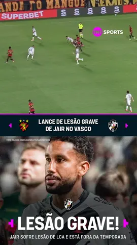O MOMENTO DA LESÃO DE JAIR! 🤕💢 O jogador do Vasco teve diagnosticada lesão do ligamento cruzado anterior, lesão do ligamento colateral medial, meniscos e lesão osteocondral e está fora da temporada. O árbitro Raphael Claus não deu falta no lance. Desejamos uma boa recuperação! 🙏 #BrasileirãoBetano #Futebolbrasileiro #vasco #vascodagama #jair