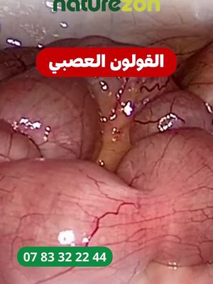 إملا الاستمارة في الموقع  و نحن سنتواصل معك 
