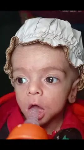 ✨ “Every new day brings new hope… and today, Baby Abubakar is shining brighter than ever!” ✨ In this update, you’ll see how our little warrior is growing stronger, step by step. His feeding is improving, his movements are better, and his innocent smile is a reminder that miracles do exist. 🌸 Royal NICU is not just a hospital — it’s a family where every prayer, every donation, and every kind word becomes a part of this baby’s healing journey. 💖 👶 Join us in celebrating Baby Abubakar’s progress, because together we are writing a story of survival, love, and hope. #BabyAbubakar #RoyalNICU #MiracleBaby #HopeLivesHere