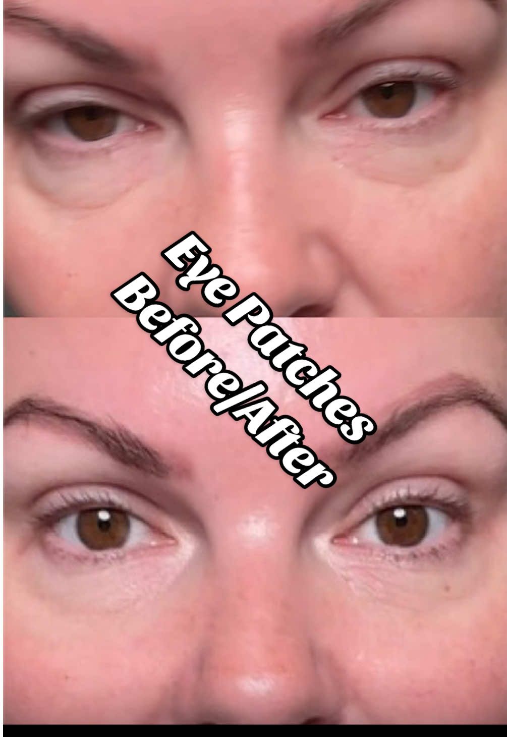 Some Of The Best Eye Patches! #thicknstrong #eyepatches #skincare #eyepatch #tiktokshopcreatorpicks 