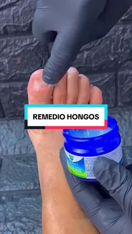💅 El remedio natural más eficaz contra los hongos en las uñas 👉 ¿La clave? Ingredientes con poder antifúngico y antiséptico: ✅ Vicks VapoRub (eucalipto + alcanfor) ✅ Bicarbonato de sodio ✅ Agua oxigenada ✅ Vinagre ✨ Mezcla todo, aplícalo con un cepillo en uñas de manos o pies y deja que actúe. No solo elimina hongos y suciedad, también ayuda a prevenir que regresen. 👉 Comenta UÑAS si lo vas a probar y síguenos para más remedios naturales. #uñas #remedioscaseros #salud 