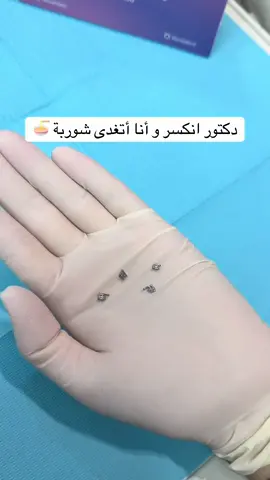 #اكسبلور #explore #foryou #viral #fyppppppppppppppppppppppp 