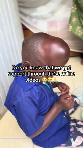 Link in the bio to donate #headsurgery #linkinthebio #disability #homelesskids #hungry @Selena Gomez @Taylor Swift @Khabane lame @Kylie Jenner 