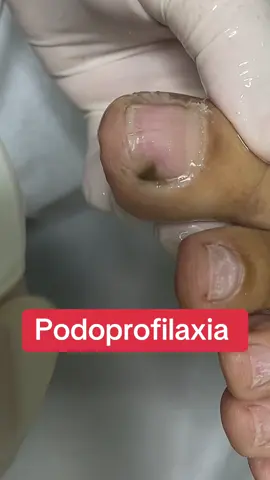 Podoprofilaxia dos pés 🦶 #podoprofilaxia #pes #pies #foot 