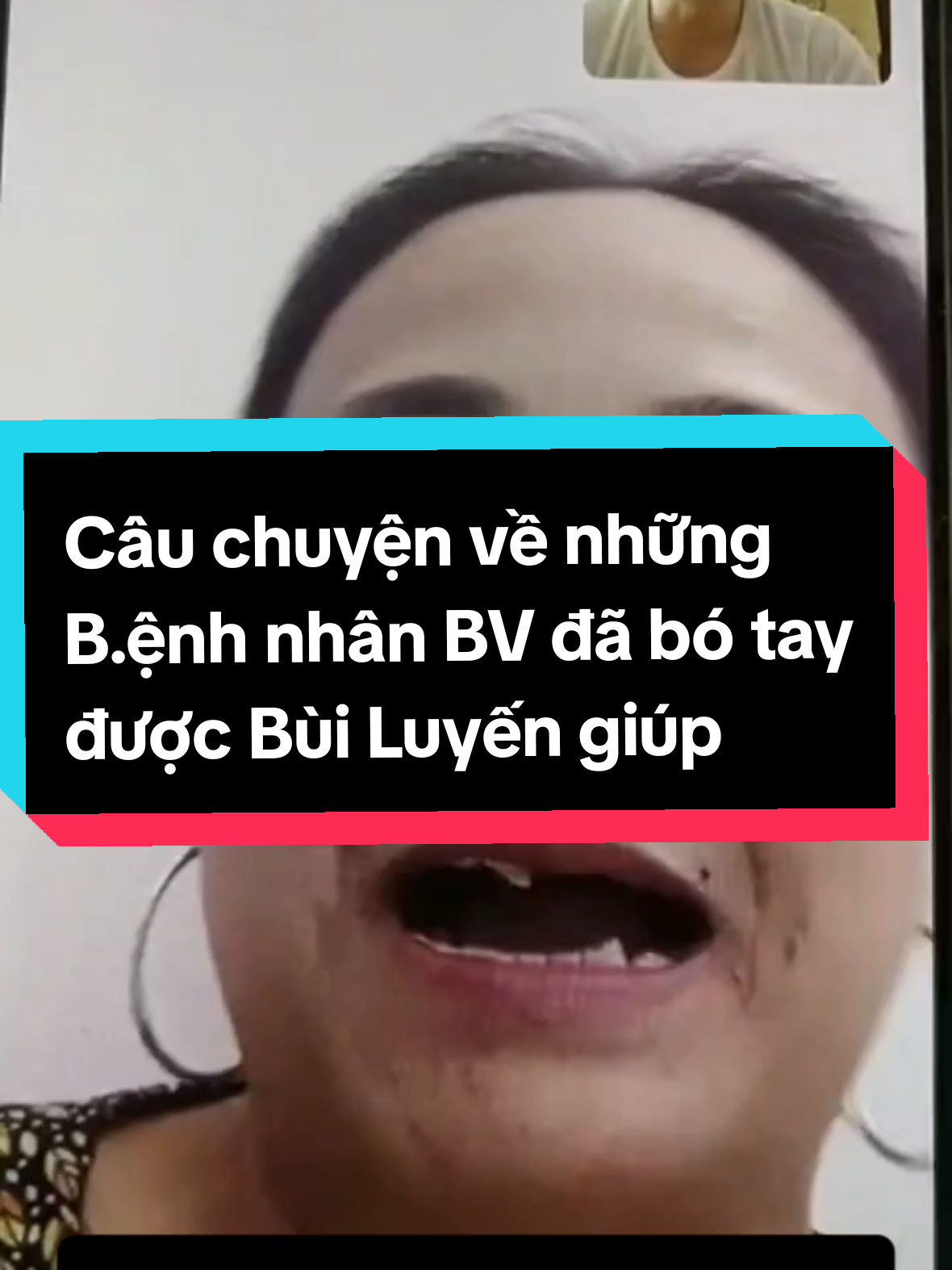 #CapCut 