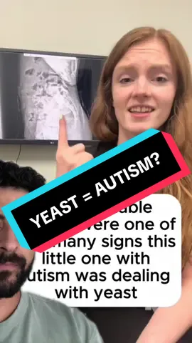 Does treating yeast overgrowth help with autism? Stay to the end for a surprise #ASD #autism #smellnessway #misinformation #sciencetok
