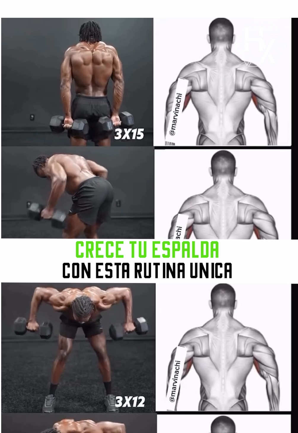 ¡Prueba este entrenamiento solo con mancuernas! Sin máquinas ni cables: ¡ganancias puras con mancuernas! Trabaja trapecios, dorsales y deltoides posteriores para ganar anchura, grosor y definición. 📝 Instrucciones de entrenamiento ➡️ Encogimientos de hombros con mancuernas: 3 series x 15 repeticiones (Trabajo de trapecio) ➡️ Remo con giro inclinado: 4 series x 10 repeticiones (Dos dorsales + core) ➡️ Remo con deltoides inclinado: 3 series x 12 repeticiones (Deltoides posteriores y espalda alta) ➡️ Remo inclinado + Aperturas de espalda: 4 series x 8 repeticiones (Activación completa de la espalda) ✅ Descansa de 90 a 120 segundos entre series para maximizar la recuperación y el rendimiento. ¡Manos a la obra! 🙌🔥  #ESPALDA #BACK #REMO #ROW #LATS               