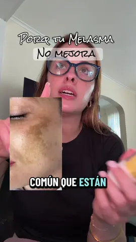 Porq tu Melasma no mejora #melasma #melasmatreatment #melasmatratamento #melasmaskincare #melasmacream  